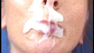 Aged Thick Facial