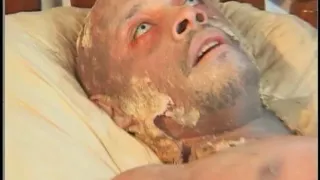 Darksome man nails white non-professional