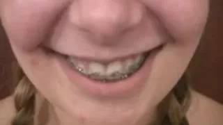 Anal Legal Age Teenager Fat