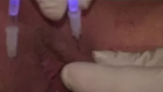 Sklavenfotze mit leuchtenden Nadeln traktiert