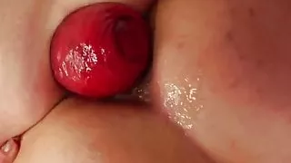 Anal prolapse party