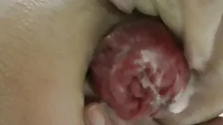 Anal self fisting and prolapse in the snow Hotkinkyjo