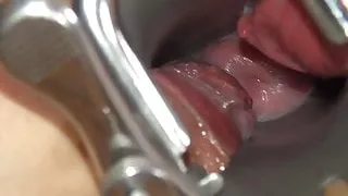 Violeta's orgasms with a speculum in her vagina