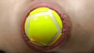 Huge balls in ass and anal prolapse - DIRTYGARDENGIRL