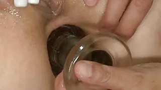 anal lesbians 1 of 3