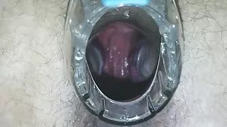 horny anus speculum closeup 720p