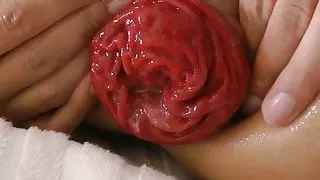 Anal balls & prolapse Hotkinkyjo 2014 summer fun