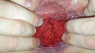 Extreme Anal Gape - Anal Stretching