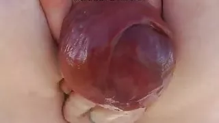 PUBLIC prolapse and fisting - Dirtygardengirl