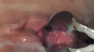 Speculum Creampie