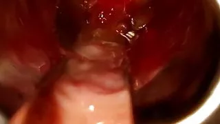 Take a look inside my bladder...