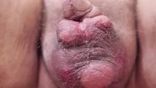 Aufpumpen der Hodensalbe durch Herrin Doktor Valeria