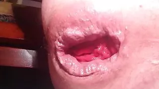 anal insertion prolapse ass gaping huge asshole