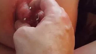 Scottish slut Sara has nipples pumped and pussy strapped  !