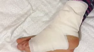 Bandage Feet Of My Wife