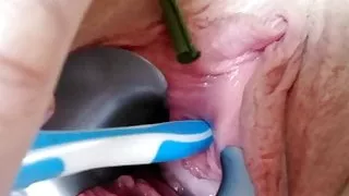 peehole stretching part 2