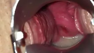 Spekulum nach ihrer Besamung