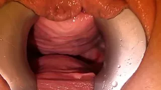 speculum et magic wand