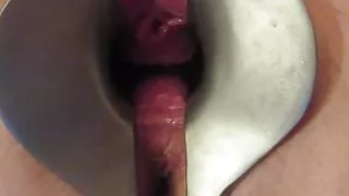 speculum insertion open pussy