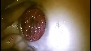 Slut wife Ass Fisted Till Prolapse