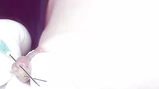 big nipple needle play2