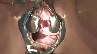 bigger Speculum in Peehole of Slave B Part II