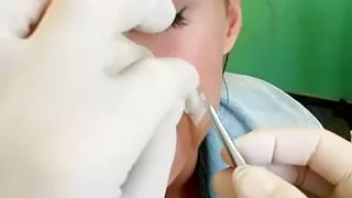 Cocksucking european patient takes cumshot