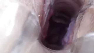 Alexa sesy speculum play