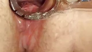 BBW opened up with speculum