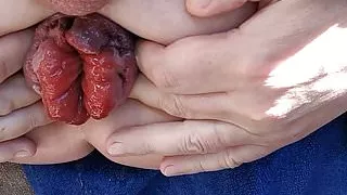 Nahaufnahme von meinem extremen Analspalt und Prolaps
