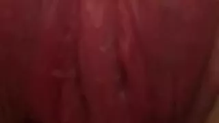 Pushing out the Puss