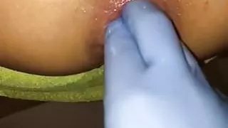 Faustfick mit klaffender Analöffnung