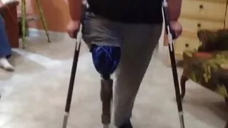big pretty hip amputee