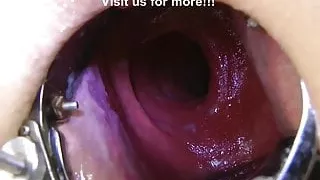 Sexy pirate Xo speculum deep insertion & belly bulge HKJ