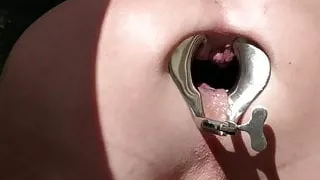 Anal extrem - Öffnung mit einem Spekulum