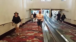 mature amputee
