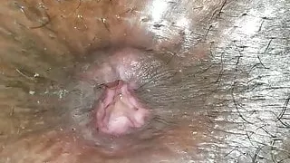 Wife's Permanently Loose Asshole