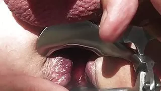 Analsex, Extrem ficken