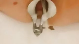 Speculum pissing