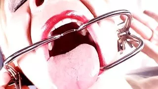 Mouth Inspection: Gagged