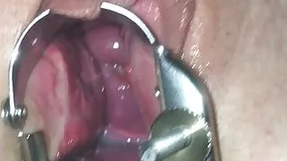 Speculum and cervix play