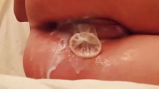 condom anus