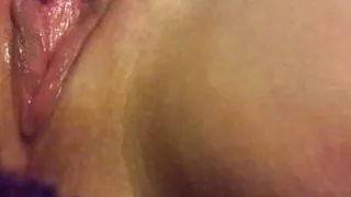 Patient Sasha-urethral stimulation