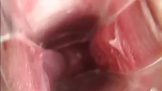 Preciosa anglosajona speculum cervix insertioon object
