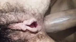 hairy Dirty Anal Close up