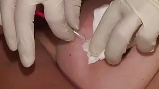 Die entnadelte Fotze, mit nadeln zum Orgasmus!