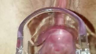 I look into my wifes pussy with spekulum big klit