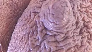 My Areolas Are Colossal The Biggest Nipples Msnovember Tits