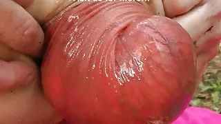 Dirtygardengirl NOVEMBER 2019 NEWS: huge prolapse, fisting