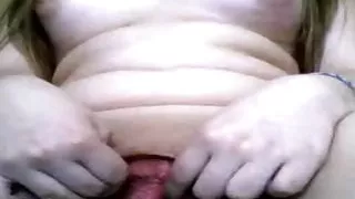 Ich war Nummer 5. Sie war schon wund und angeschwollen.